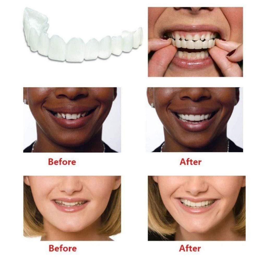 Smile Fit Flex Cosmetic Teeth Confidence Booster