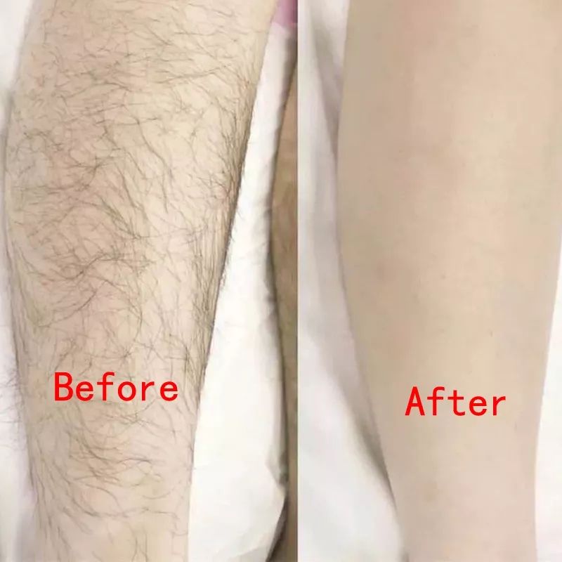 Painless Hair Removal & Exfoliation Eraser